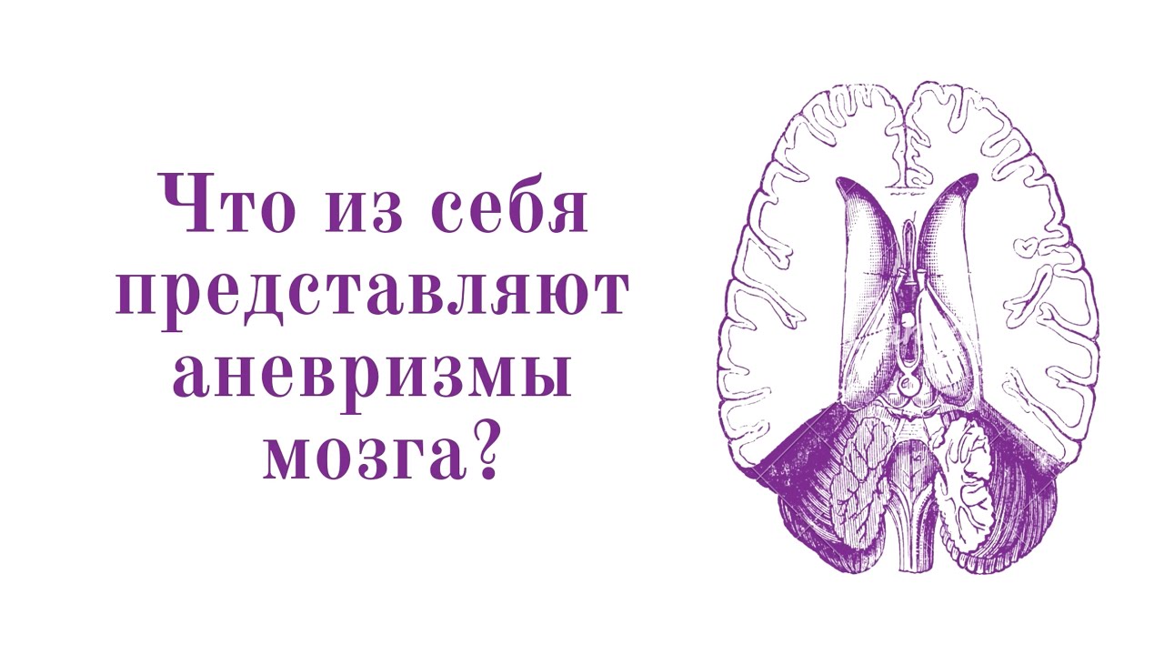 Аневризма головного мозга: симптомы, причины и методы лечения