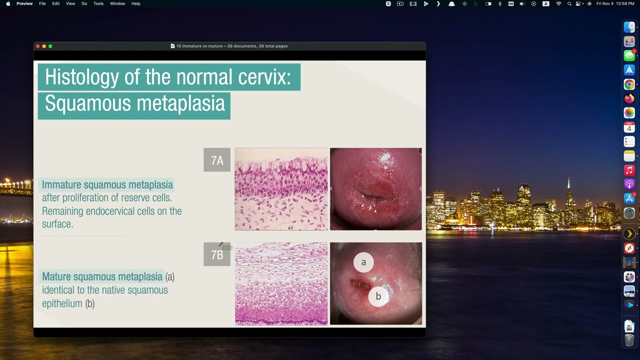 38- Cx Cancer Part I (4K) (In Arabic)