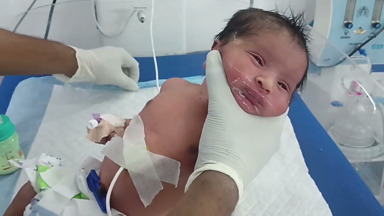 Very Emotionally 😭 & Loudly cry New Born Baby 🐥For her mother ||Then Feed Milk and calm By The Nurse