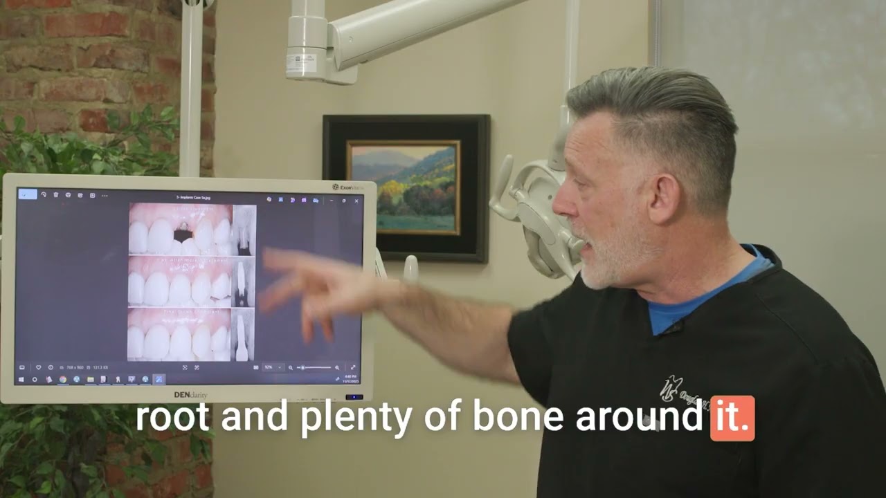 How Dental Implants Work: What to Expect from Start to Finish