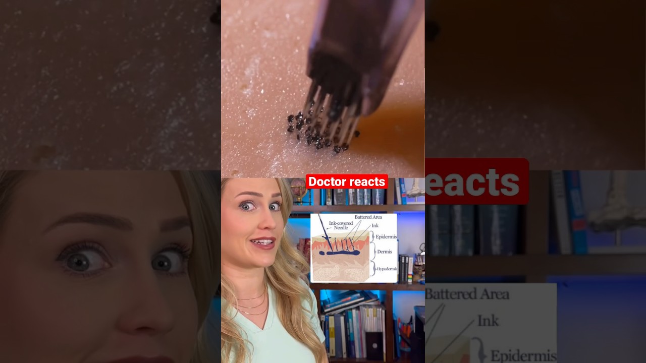 Врач объясняет: что происходит с кожей во время татуировки