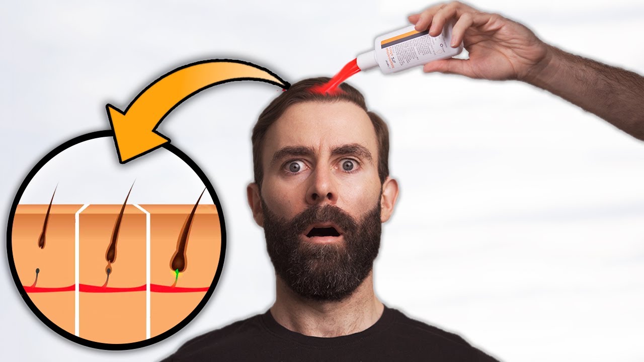 El Poder De Ketoconazol Para Recuperar El Pelo