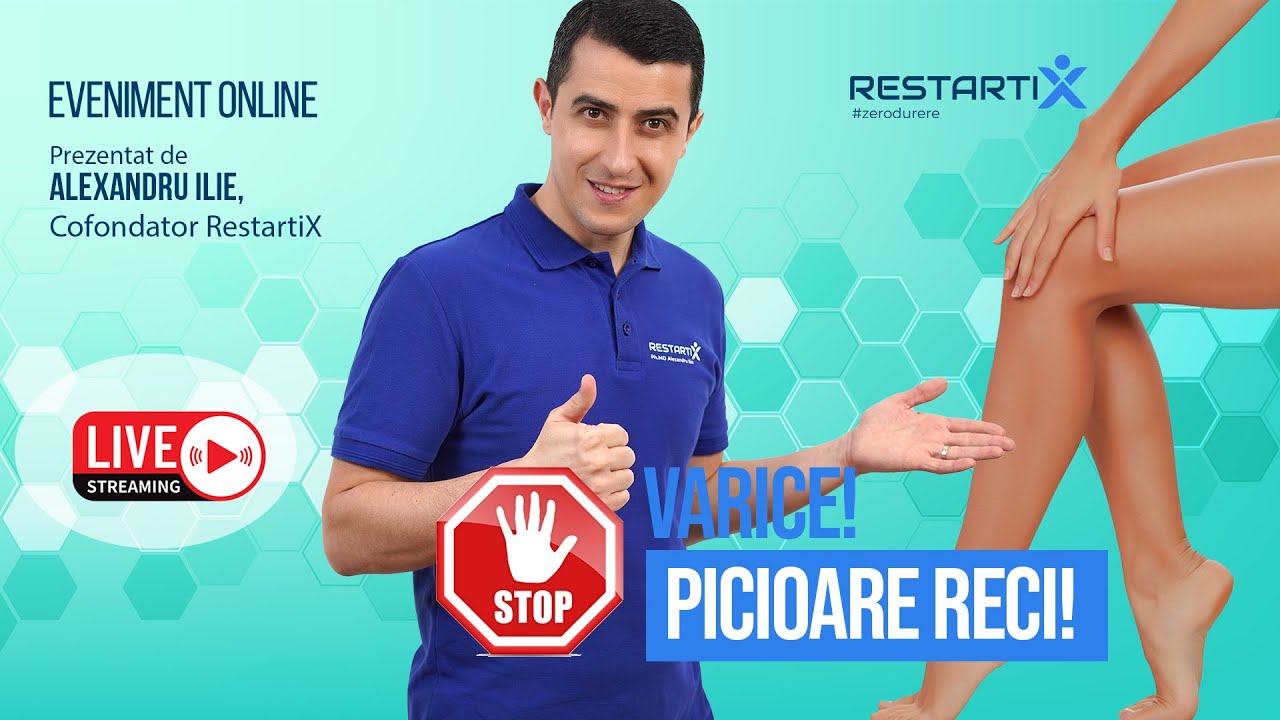 Webinar Live - Stop Varice, Stop Picioare Reci - Joi 26 Februarie, ora 19:00