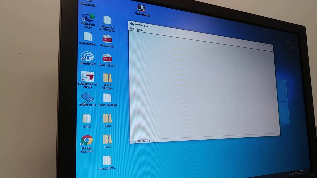 Digora Optime X-ray Sensor