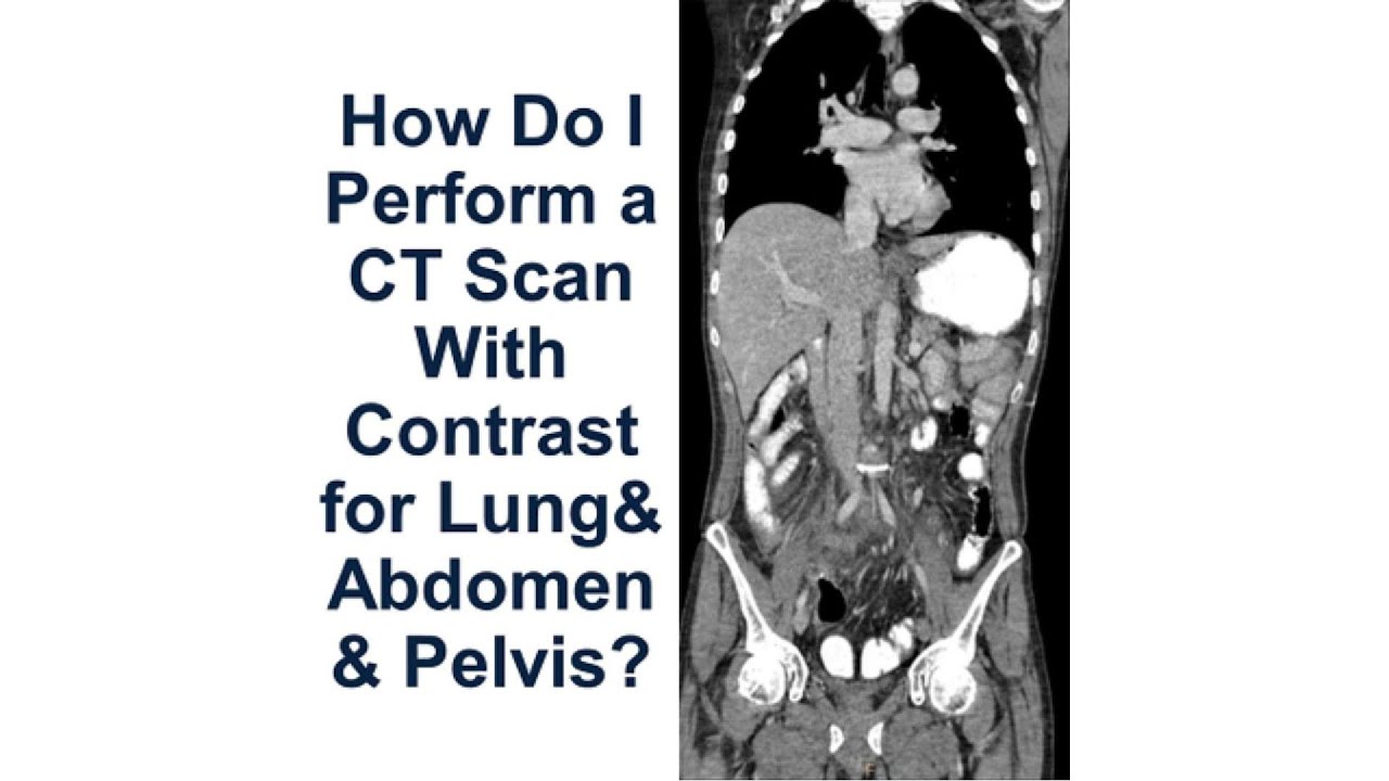 How Do I Perform a Contrast-Enhanced CT Scan of Chest, Abdomen & Pelvis? | Protocol & Patient Prep