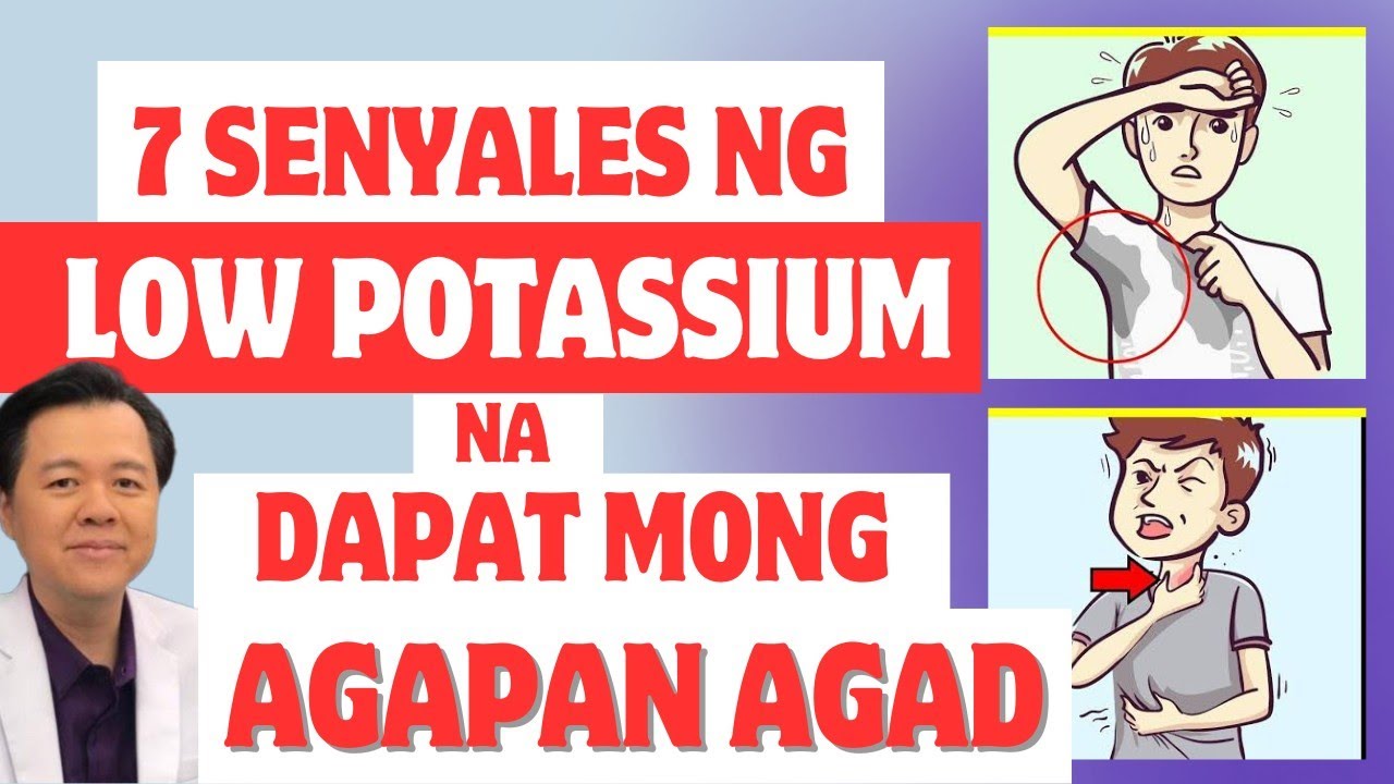 7 Senyales ng Low Potassium na Dapat Mong Agapan Agad. Delikado Ito - By Doc Willie Ong