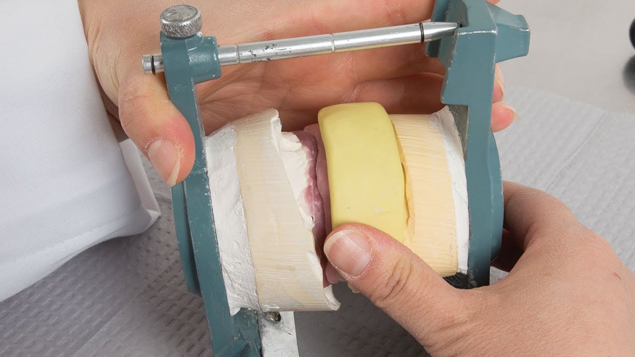 Putty Index Matrix  (Vol. 2, Issue 1)