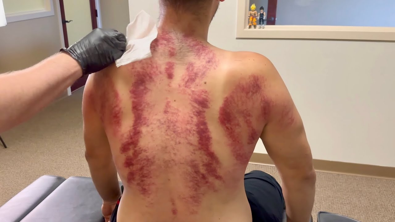 UPPER BACK SCREAMING FOR HELP!!