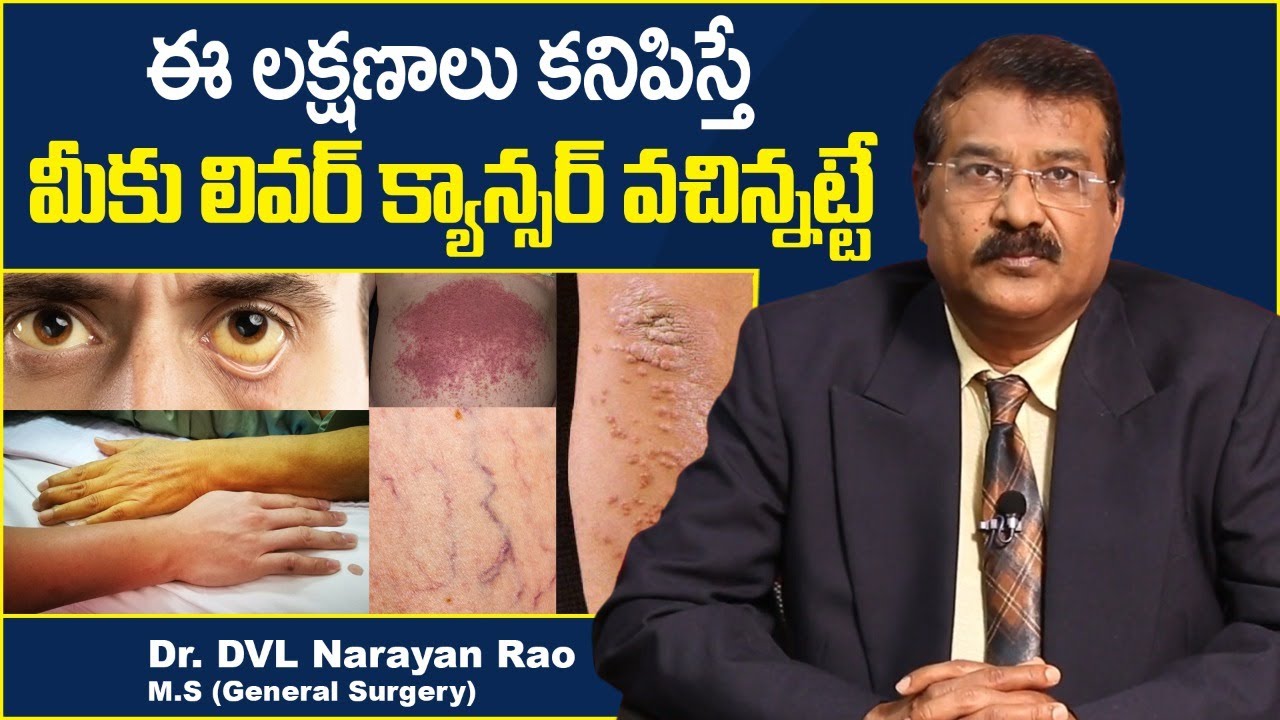 Liver Cancer Symptoms || Liver Cancer Symptoms in Telugu || Dr DVL Narayan Rao || TX Hospitals