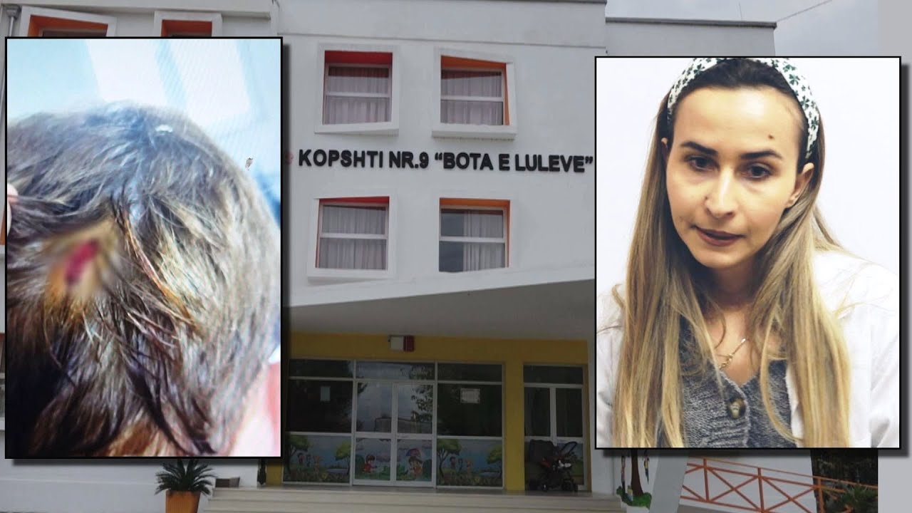 Trevjeçari gjakoset në kopësht. Kamerat s'regjistruan, prokuroria nuk verifikoi! - Fiks Fare
