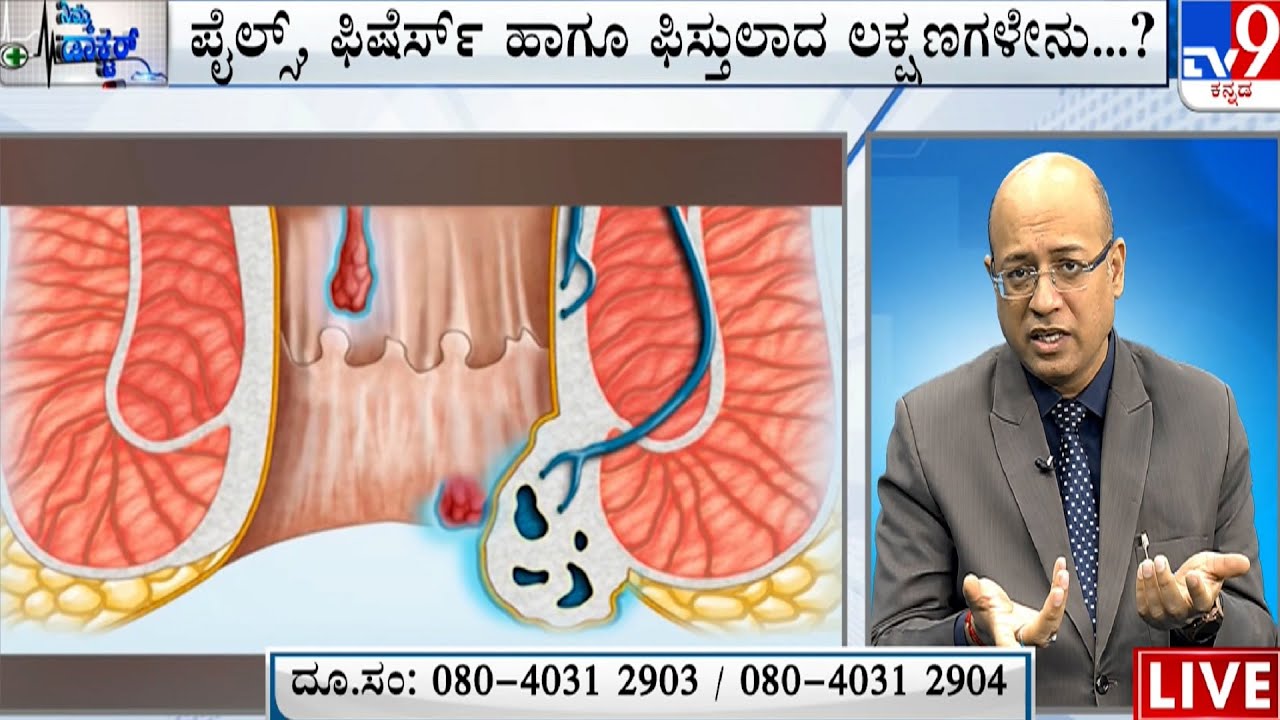 Nimma Doctor | Homeopathic Treatment For Fissure, Fistula & Piles | Homeocare International