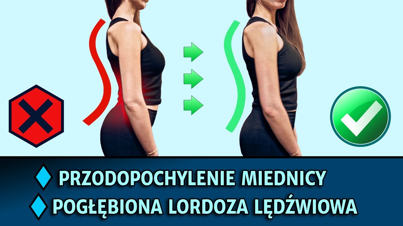 Przodopochylenie miednicy, pogłębiona lordoza lędźwiowa, ból kręgosłupa lędźwiowego, pleców. KM008