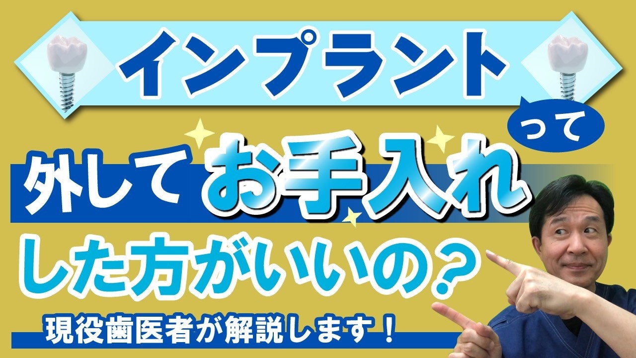 インプラントって外してお手入れした方が良いの？　現役歯医者がわかりやすく解説！