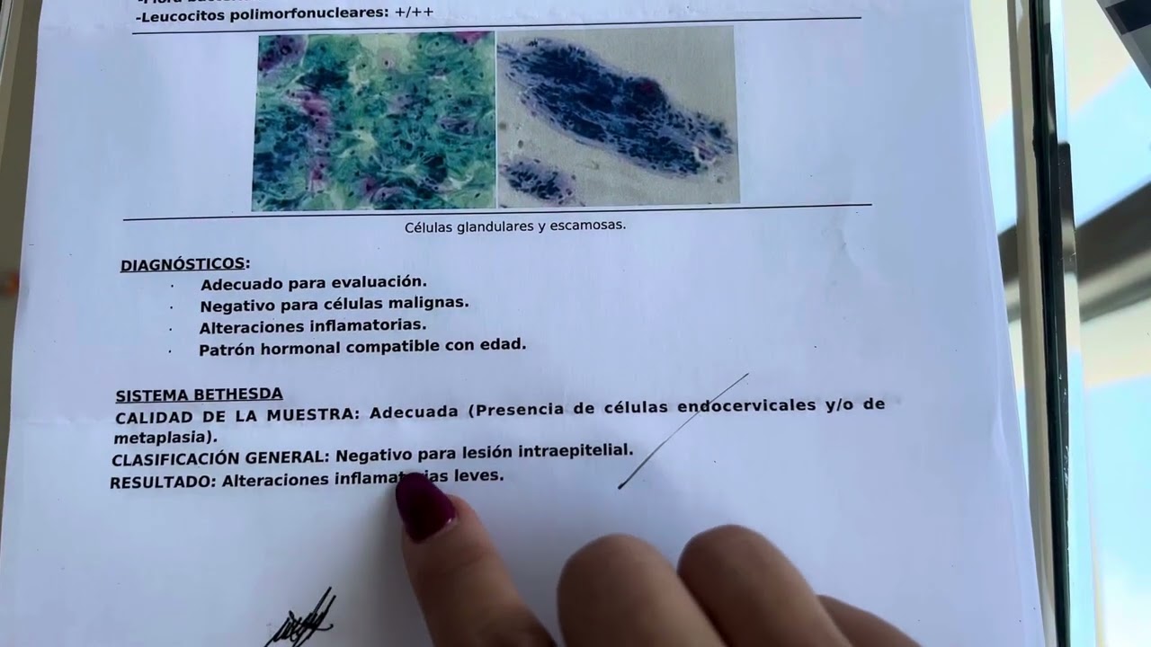 #Inflamación en tu papanicolaou? Es normal.