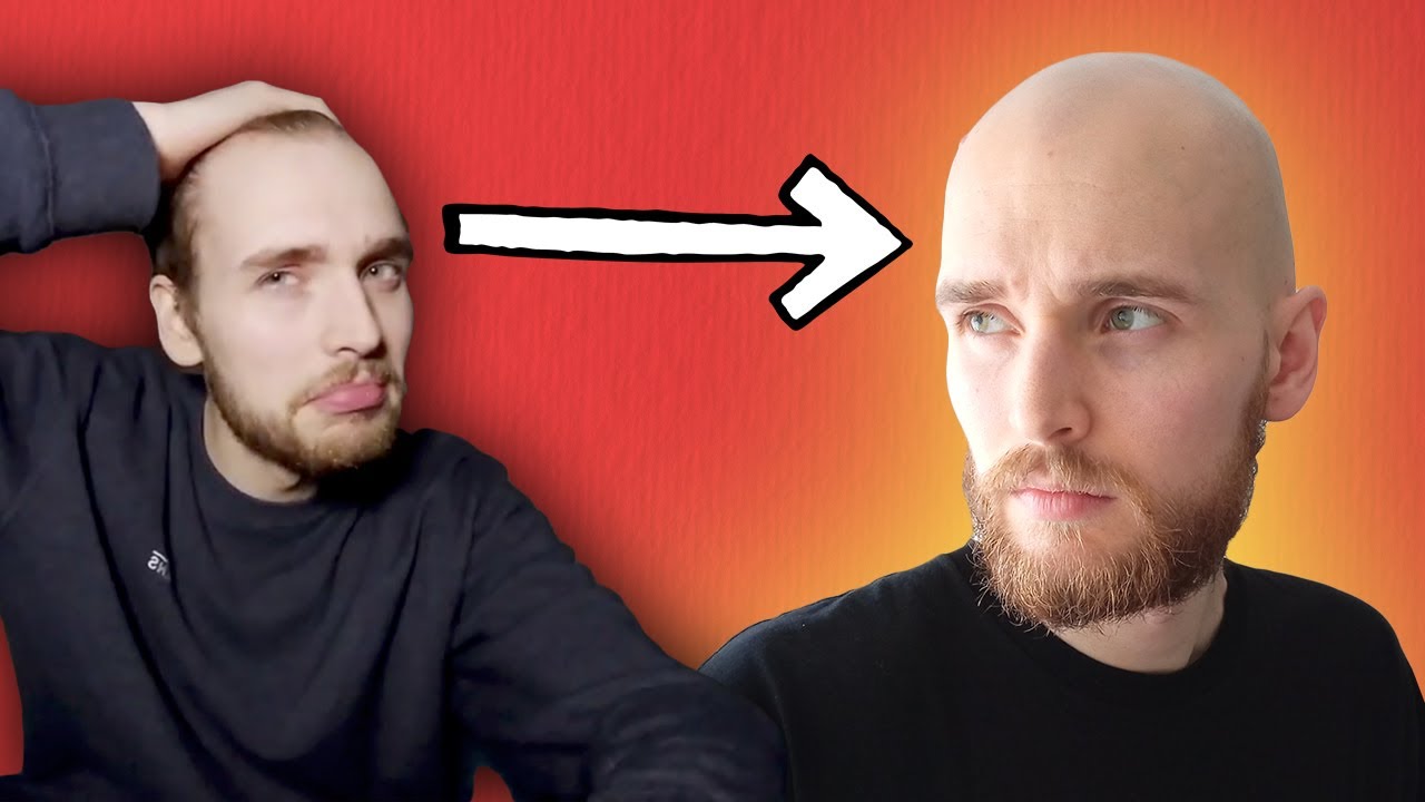 Just be bald