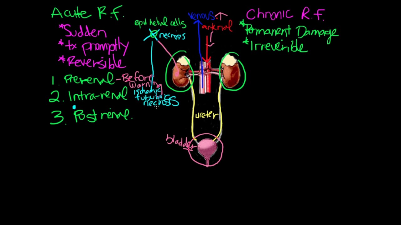 Acute vs  Chronic Renal failure - Caring Casa