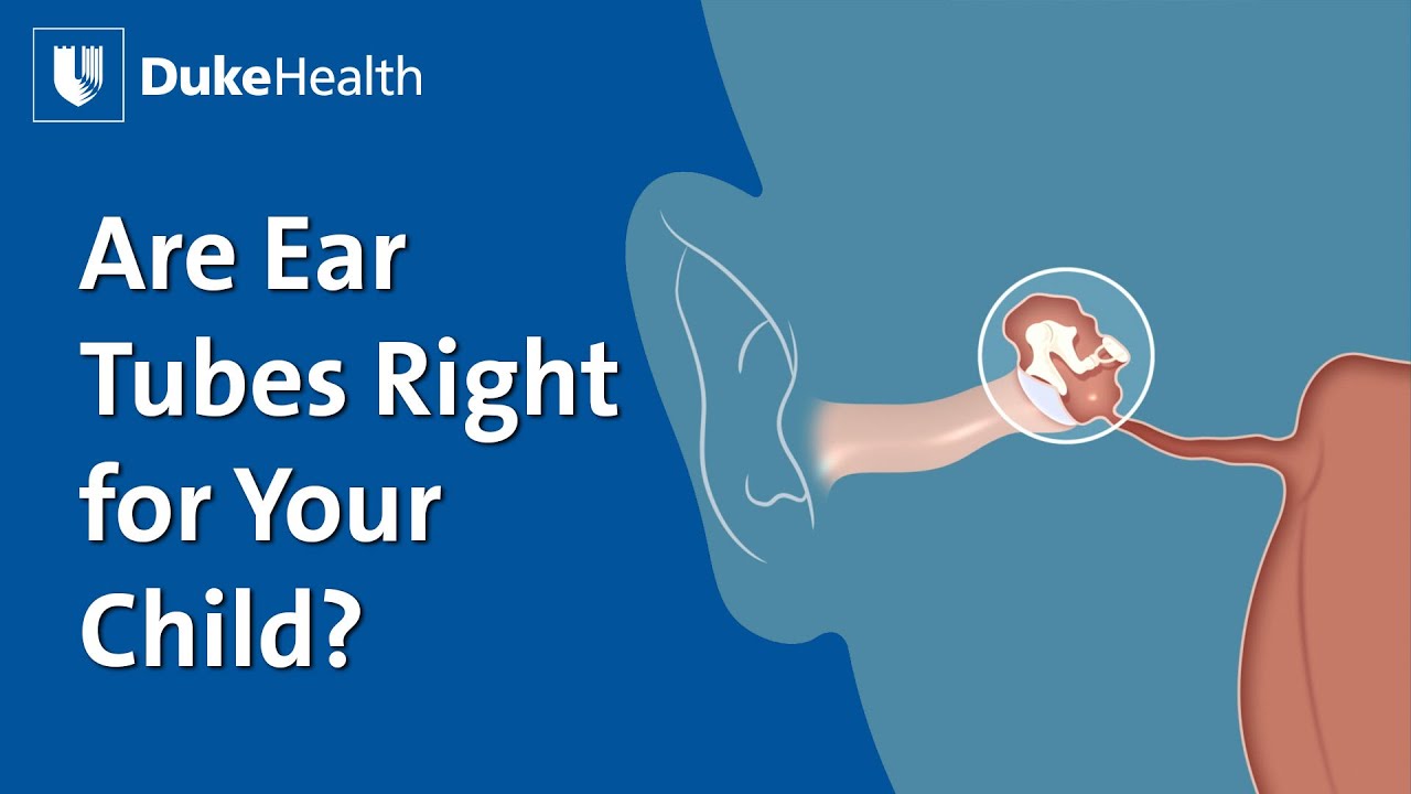 Нужны ли вашему ребенку ушные трубки? | Duke Health