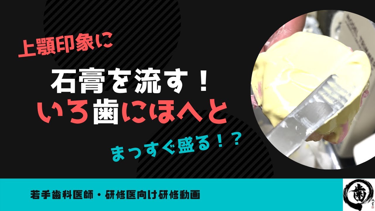 上顎印象に石膏を流す！いろ歯にほへと【若手歯科医師向け】