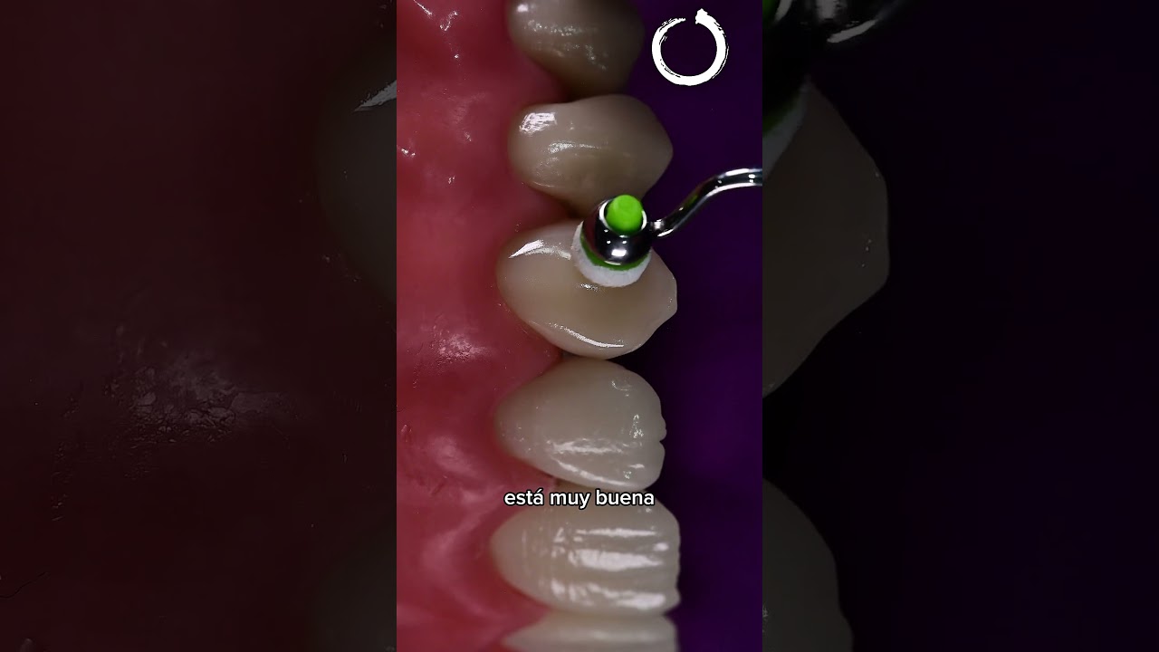 La Pendiente Mesial