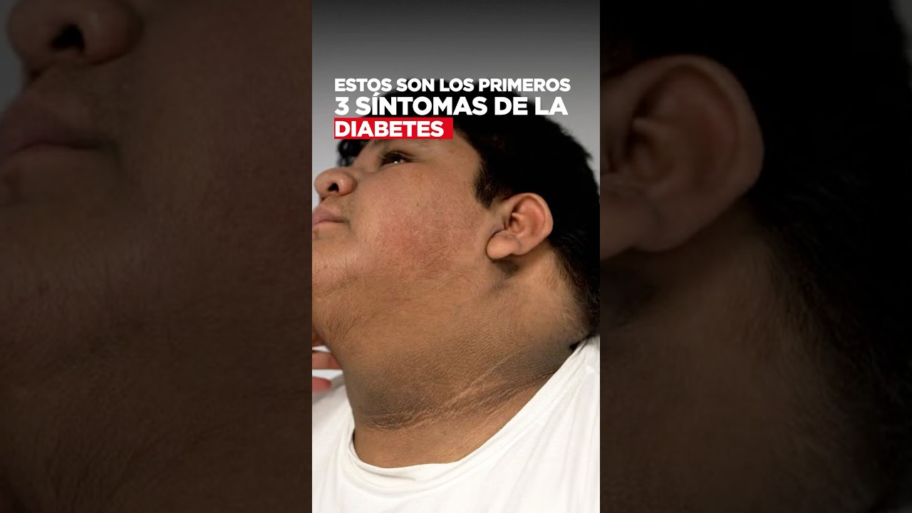 Cuidado, estos son los primeros 3 s&iacute;ntomas de la diabetes