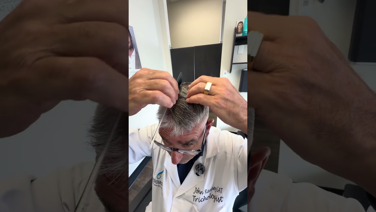Freedom Clinic | Certified Trichologist's Step-by-Step Guide to Applying Hair Loss Serum
