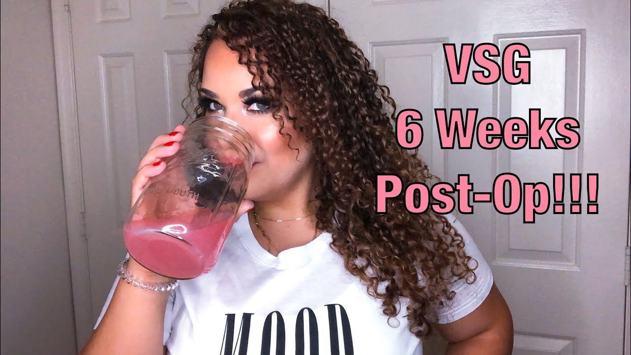 VSG 6 Weeks Post-Op!!!