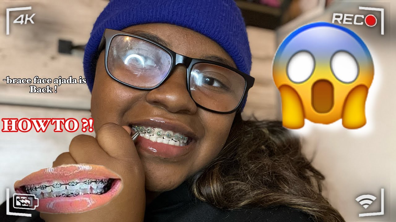 Putting on my own fake braces on myself  (I sell fake braces )