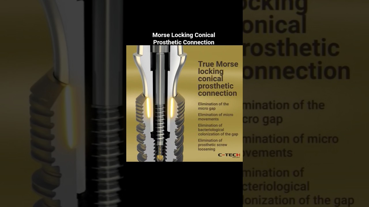 Morse Locking Conical Prosthetic Connection