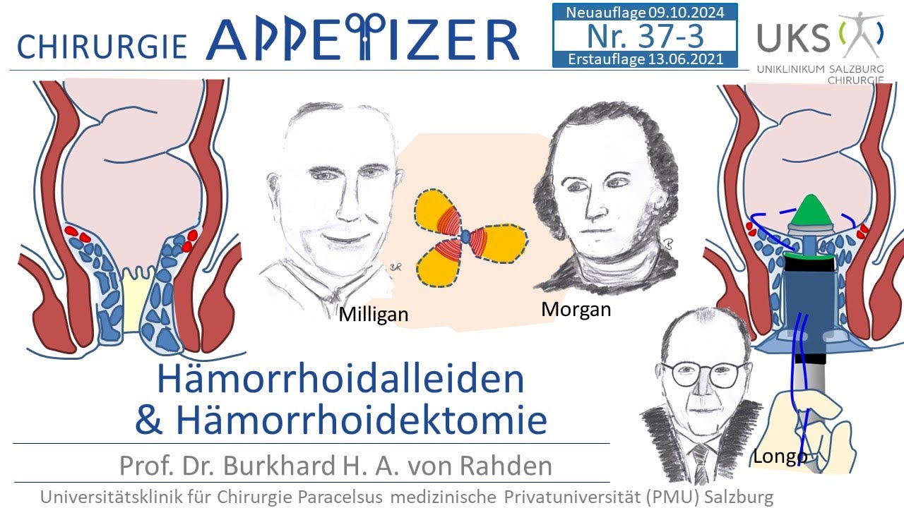 Hämorrhoidalleiden Hämorrhoidektomie CHIRURGIE APPetizer Nr. 37-3
