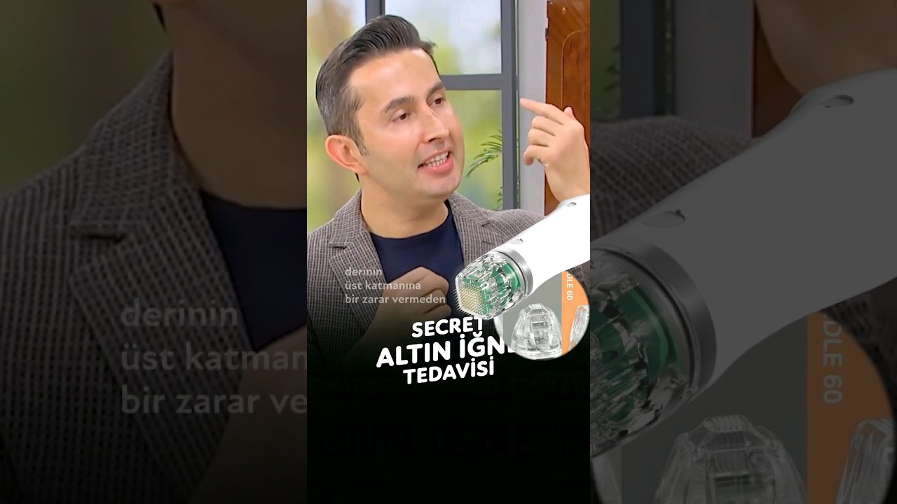 Secret Altın İğne İşlemi Nedir?