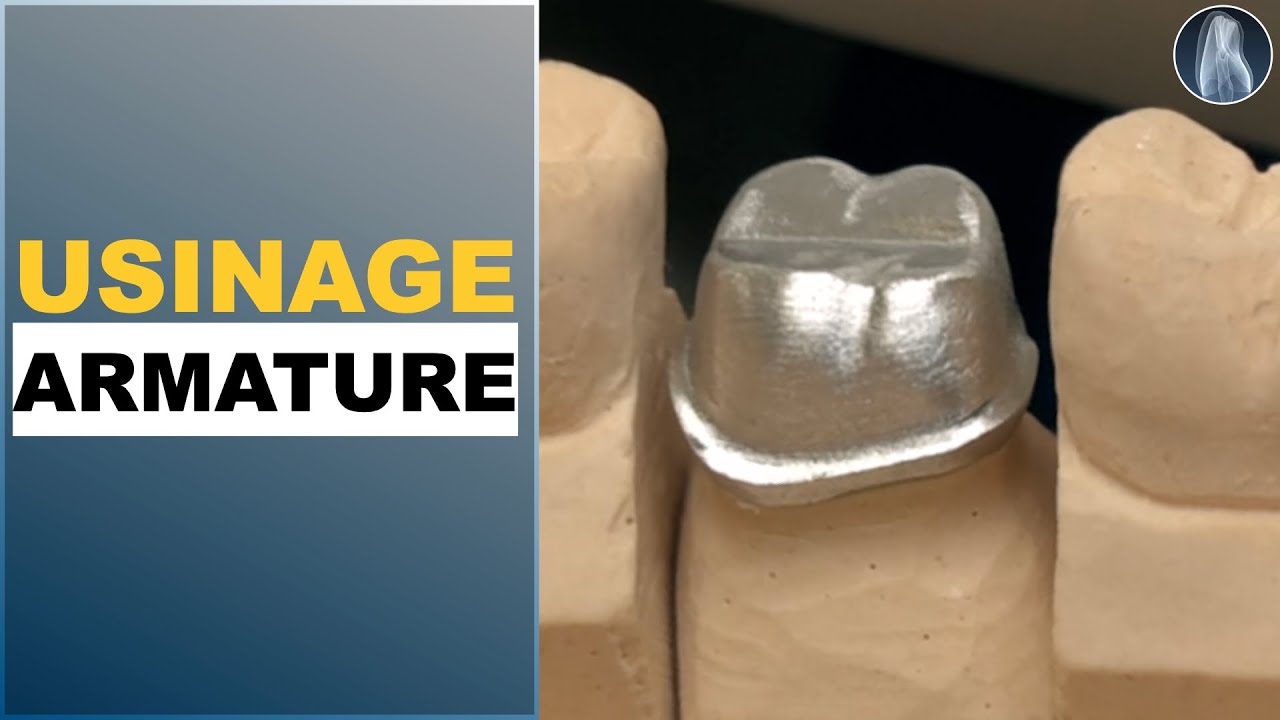 Apprenez à Usiner une Armature Métallique pour Couronne Céramo-Métallique !