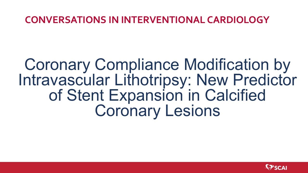 Coronary Compliance Modification IVL: New Predictor of Stent Expansion in Calcified Coronary Lesions