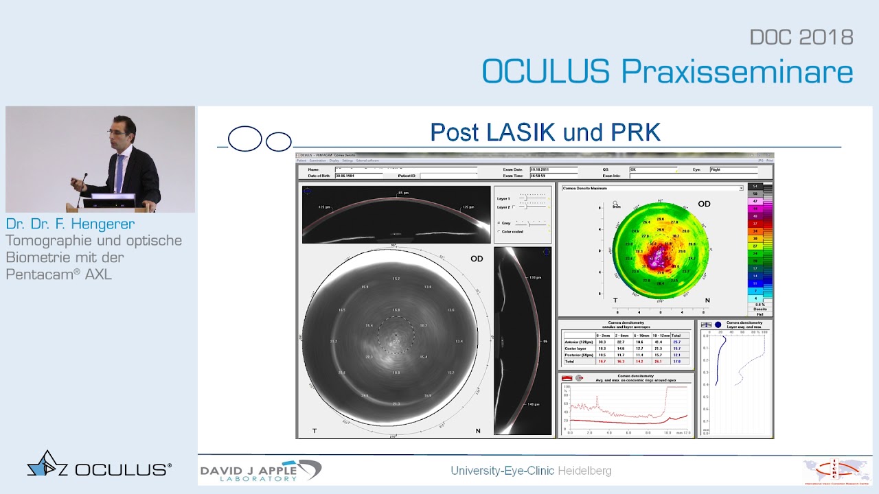 Prof. Fritz Hengerer: Tomographie und optische Biometrie mit der Pentacam® AXL