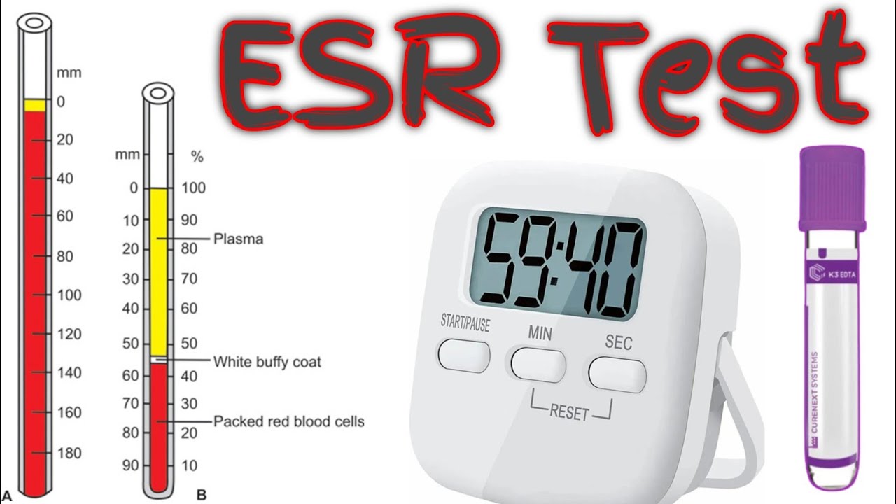ESR Test in hindi by wintrobe method practical|ESR Test wintrobe method||ESR Test #ESR