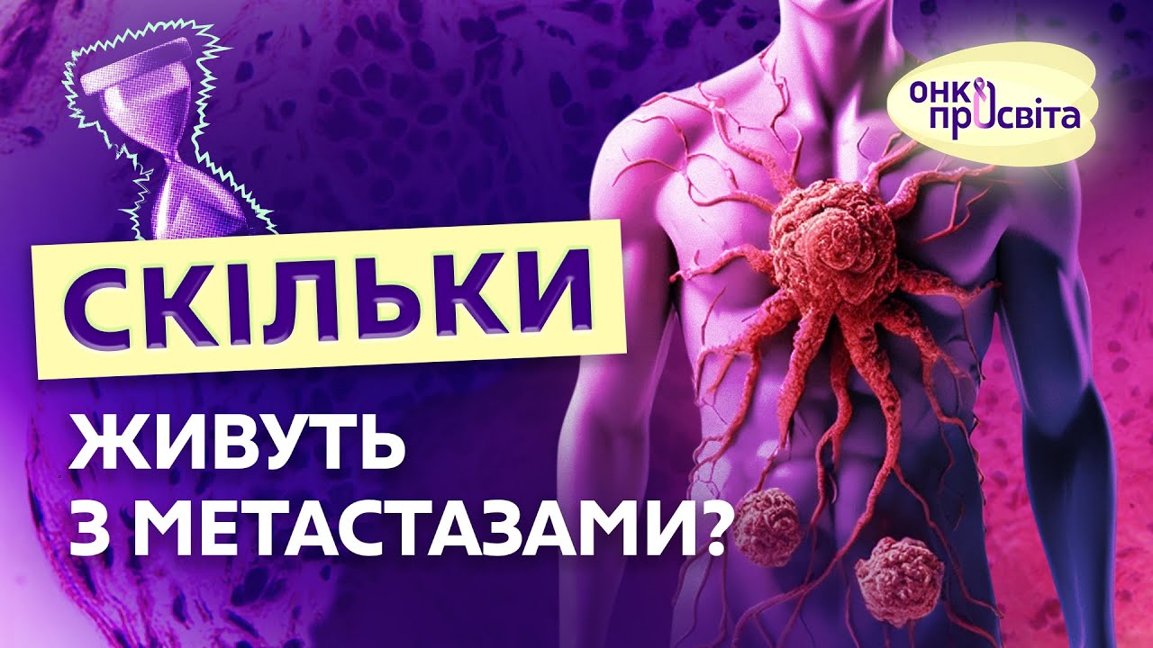 Що таке метастази, як їх лікувати? Чи можуть зникнути метастази? Розповідає онкохірург |ОнкоПросвіта