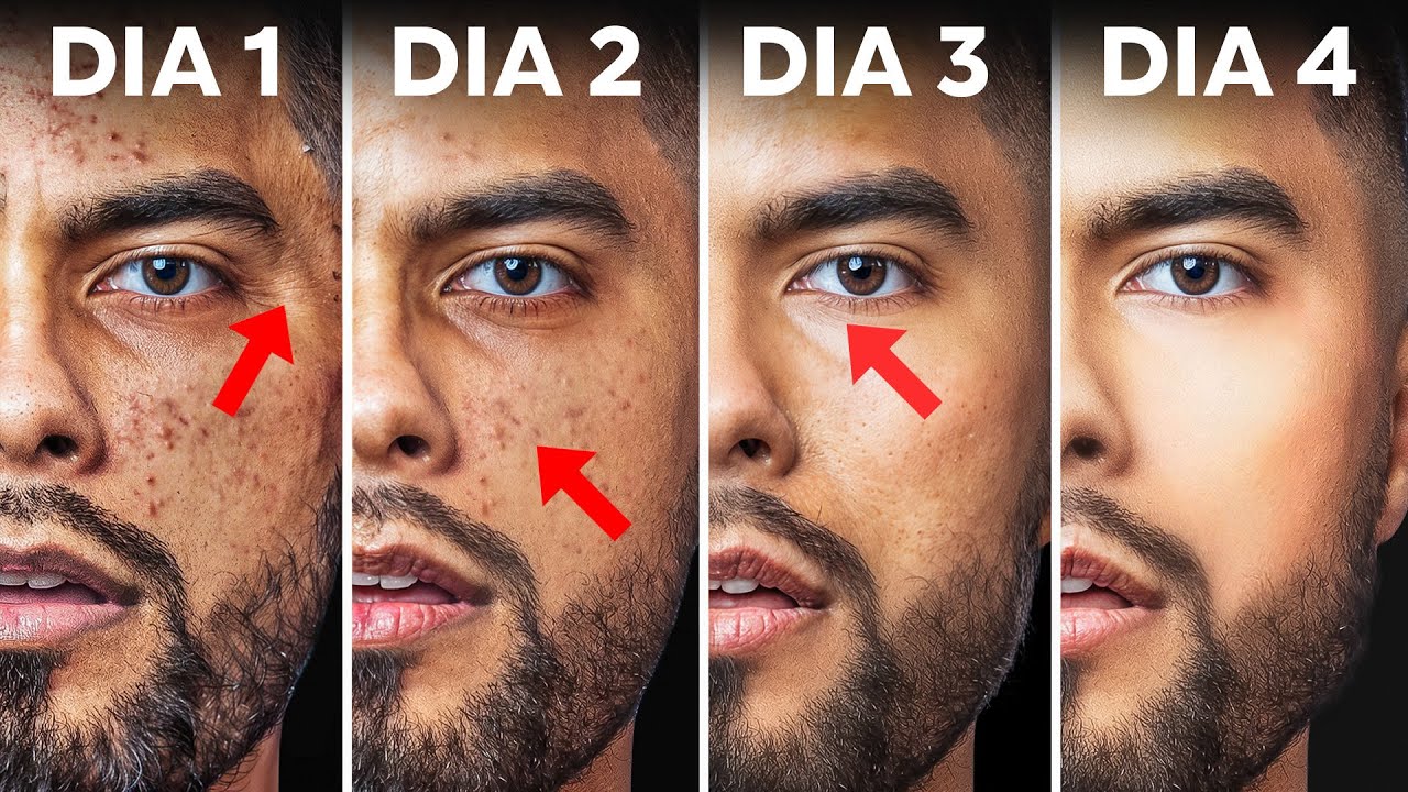 C&oacute;mo Arreglar Tu Piel En 4 d&iacute;as Con Productos De Casa