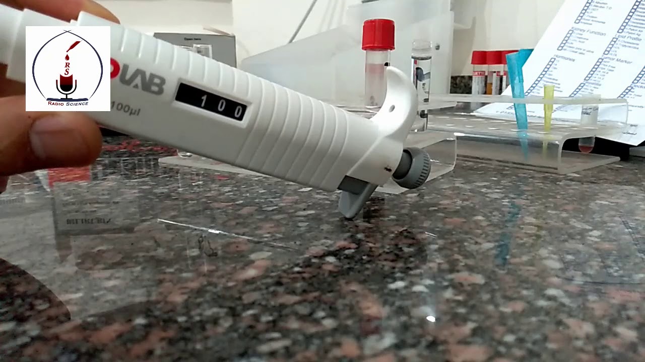 تحليل البيليروبين (الصفرا)  ..كورس التحاليل الطبية - راديو علوم