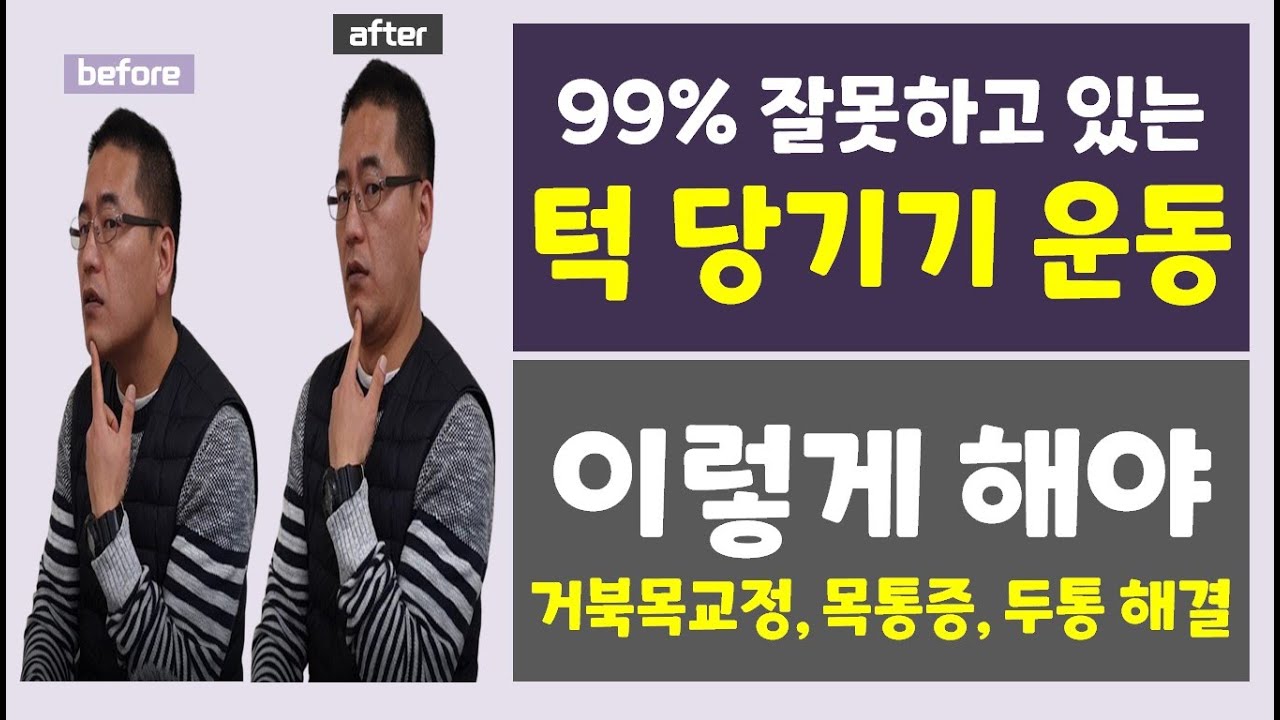 일반인 99% 잘못하고 있는 턱 당기기 운동 | 이제부터 이렇게 하세요.