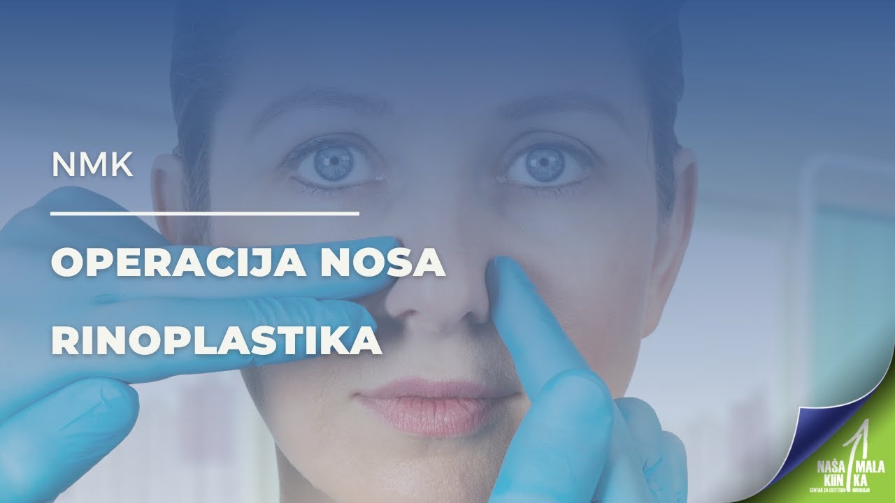 NMK - Operacija nosa - Rinoplastika