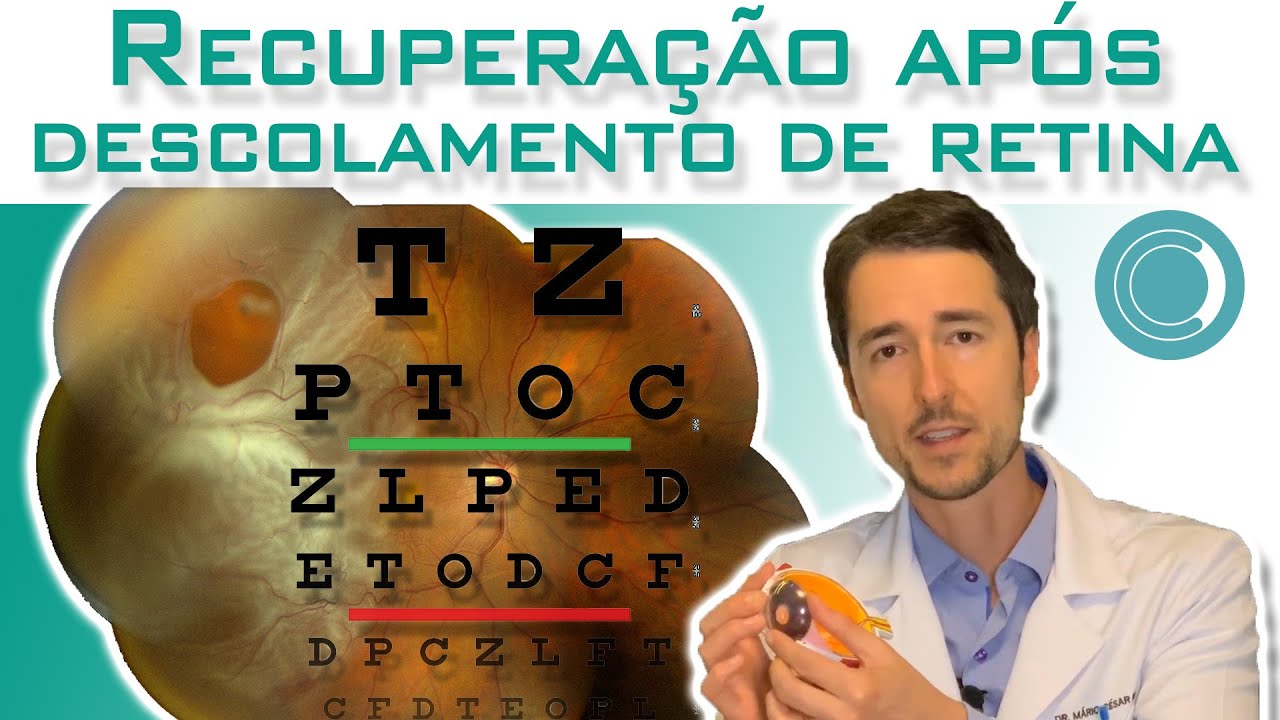 Recuperação da visão após cirurgia para descolamento de retina