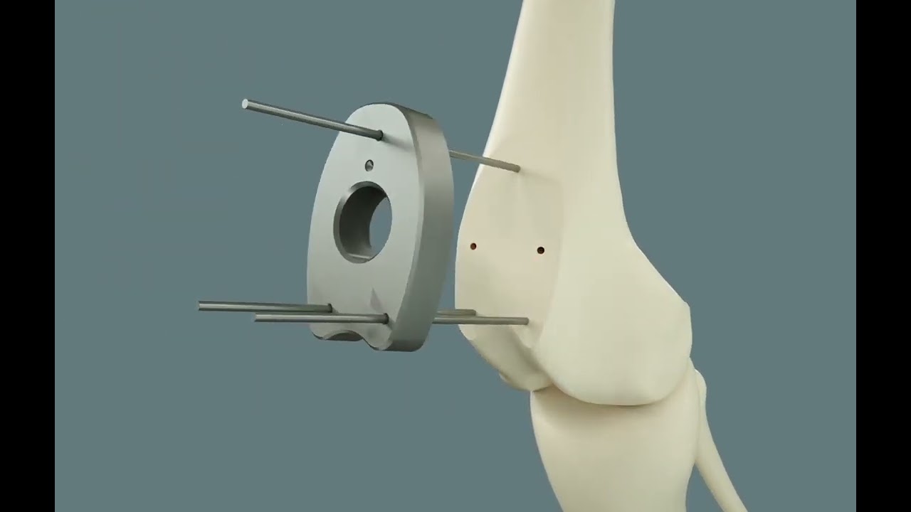 Patellar Groove Replacement in dogs in Vancouver.