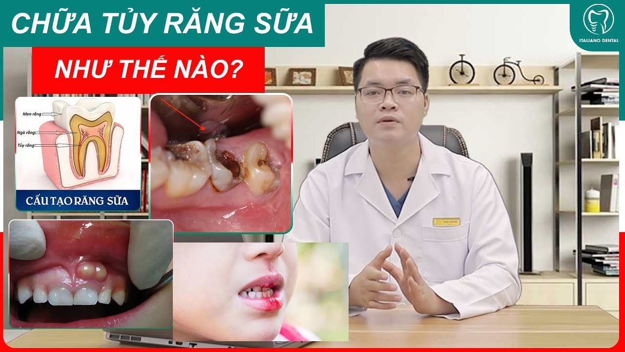 [ KIẾN THỨC NHA KHOA] Điều trị tủy răng sữa như thế nào?