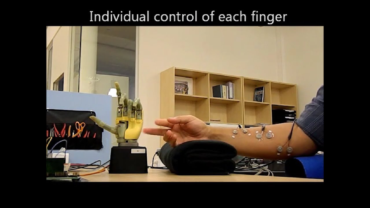 Myoelectric control of individual fingers in a hand prosthesis, initial testing