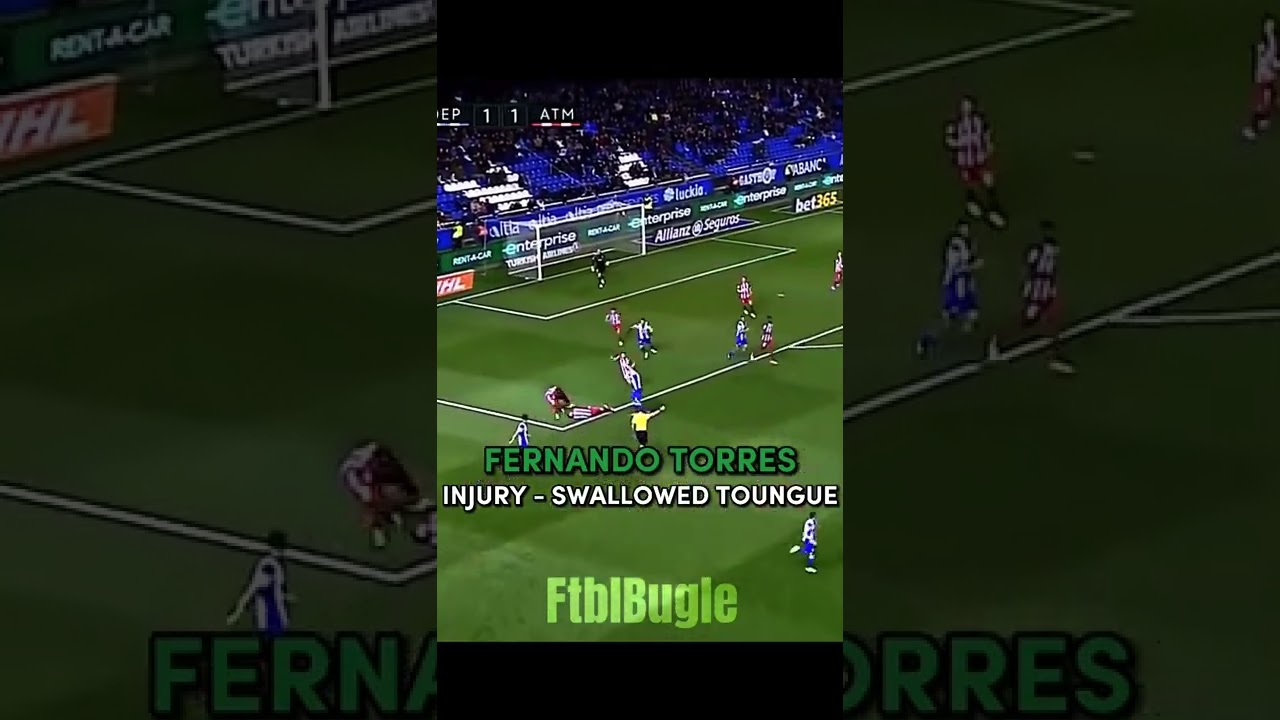 Some of the worst injuries I&rsquo;ve ever seen&hellip;🤕 Pt.3 #football #shorts #injury #fernandotorres