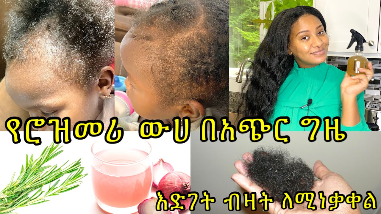 ⭐️ሮዝመሪ ለፀጉር ብዛት ማሳደጊያ እንደዚ ተጠቀሙት  በህክምና ከሞኖክሲድል እኩል ለፀጉር እንደሚጠቅም ተረጋገጠ/ Rosemary hair grows