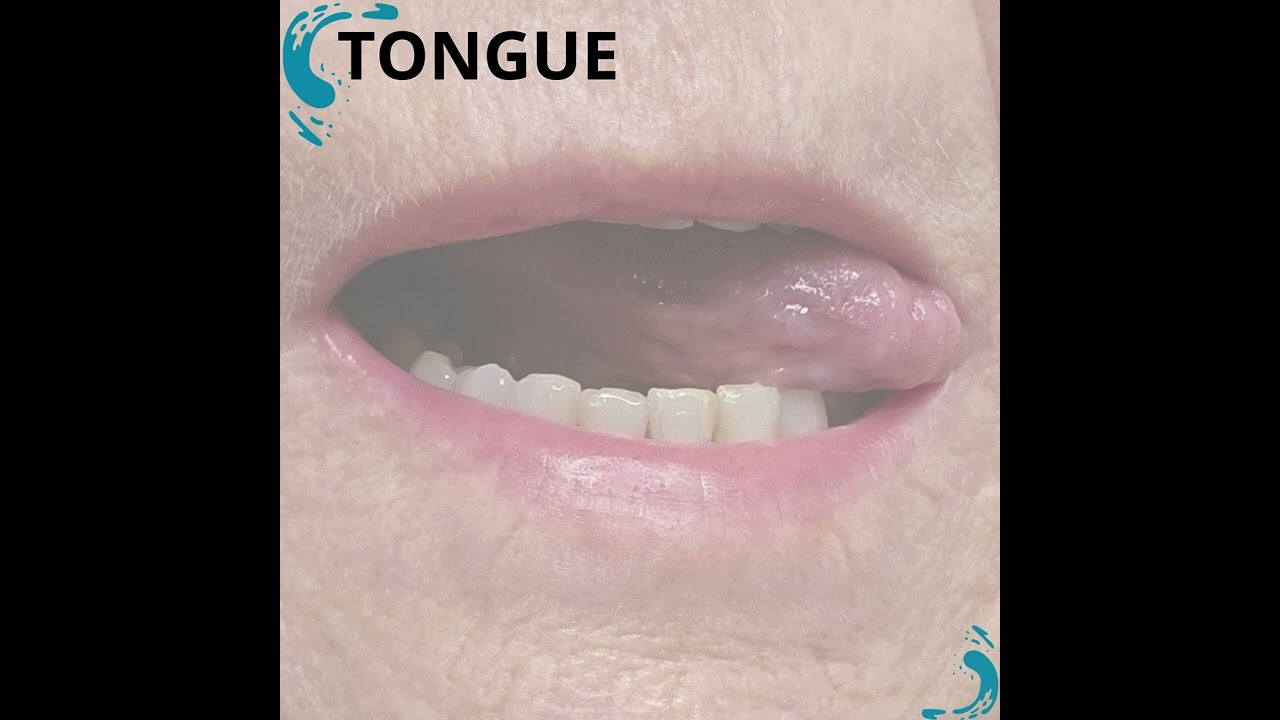 It's Check Up Tuesday. The day each month we remind you to check for signs of #mouthcancer