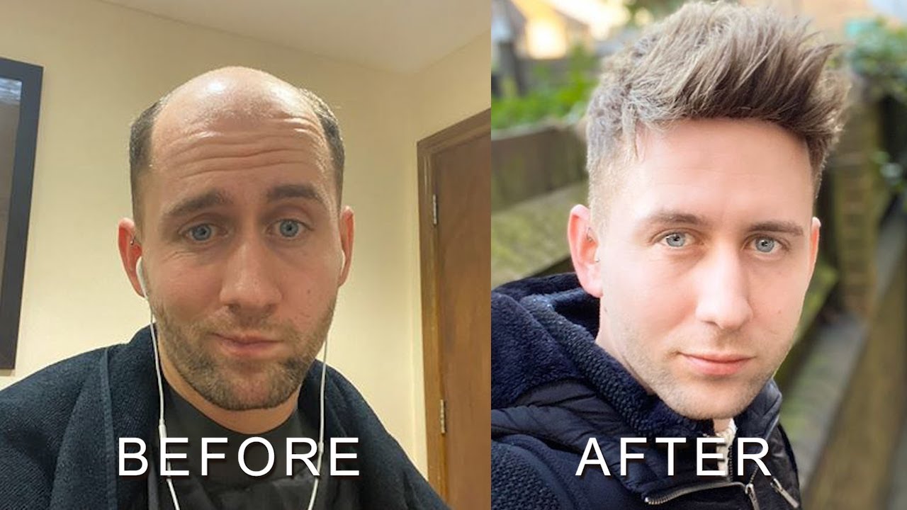 Customer Honest Review of LaVivid Versalite Men's Toupee Hairpiece