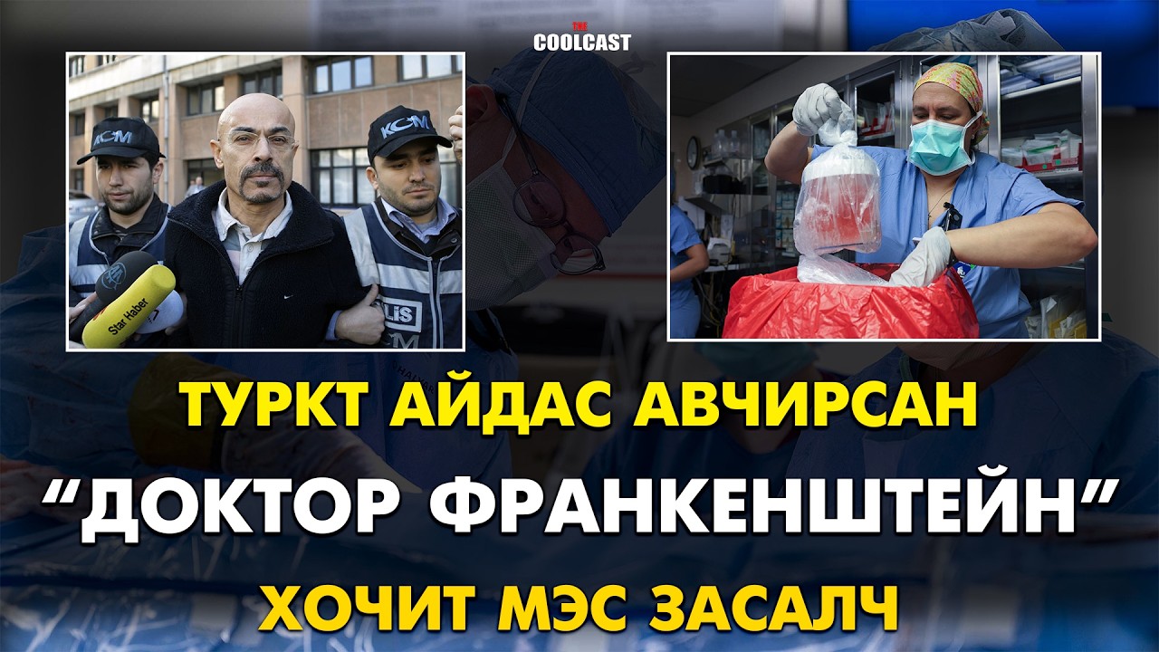Туркын эрхтний наймаачин &ldquo;Доктор Франкенштейн&rdquo; хочит мэс засалч