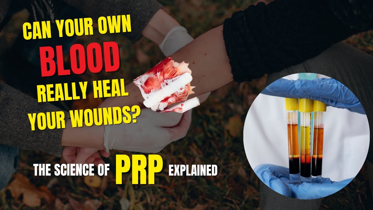 Can Your Own Blood Really Heal Your Wounds? The Science of PRP Explained