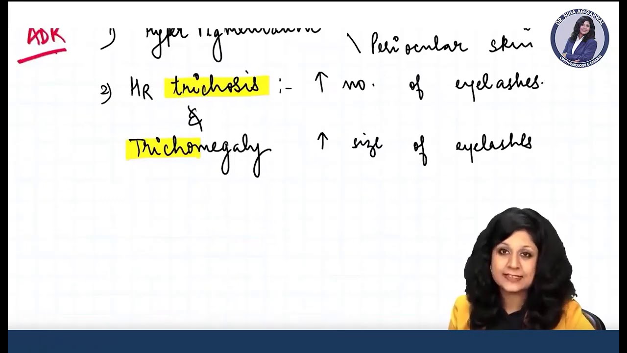 Ophthalmology Rewind_ Anti Glaucoma Drugs_ NEET PG Preparation || Dr. Niha Aggarwal